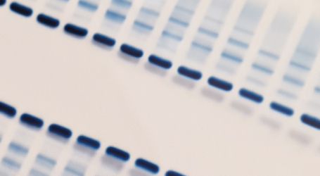 IMPORTANCIA DEL PROTEINOGRAMA EN LAS DECISIONES CLÍNICAS